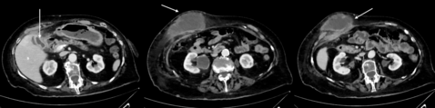 More than your normal right upper quadrant pain